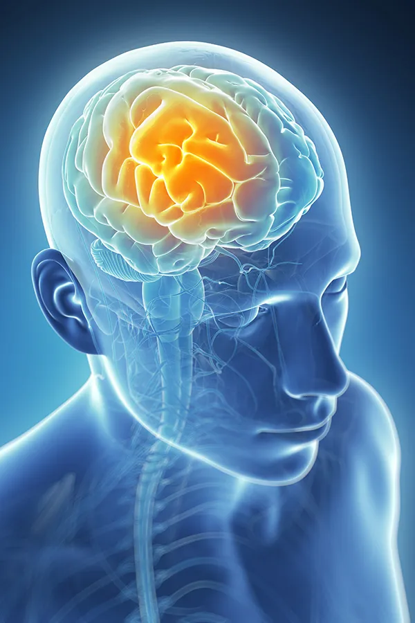 Migraine-Treatment 3D illustration of the brain with glowing pain center. Markham Natural Health Centre treats migraines using functional medicine in Greater Toronto.